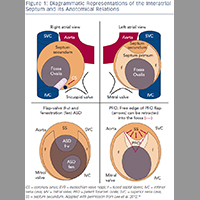 Atrial septal defects and patent foramen ovale